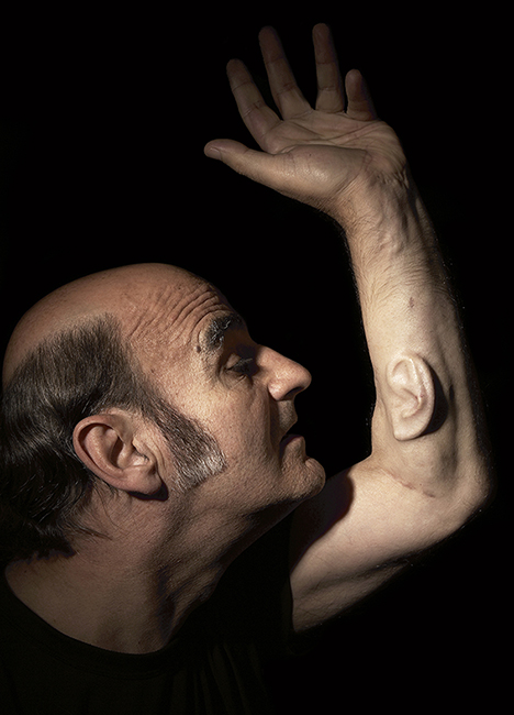 Stelarc’s “Ear on Arm,” in London, Los Angeles, and Melbourne, 2006.